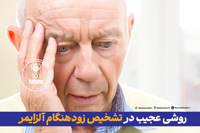 روشی عجیب در تشخیص زودهنگام آلزایمر!