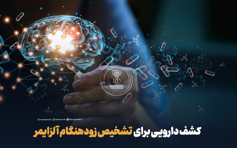 کشف دارویـی برای تشخیص زودهنگام آلزایمر!