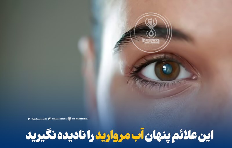 این علائم پنهان آب مروارید را نادیده نگیرید! 👁