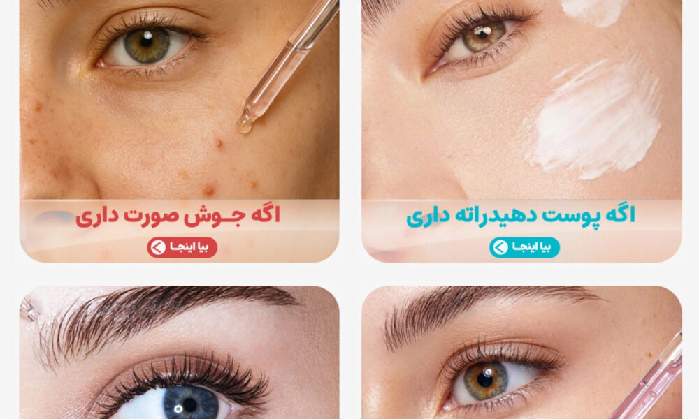 زنونه