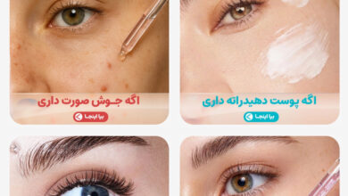 زنونه